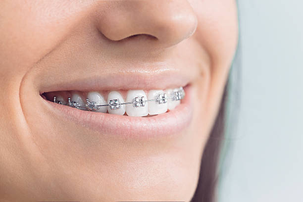 Best Wisdom Tooth Removal  in Trotwood, OH
